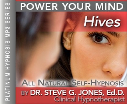 Relieve Hives - Platinum Hypnosis